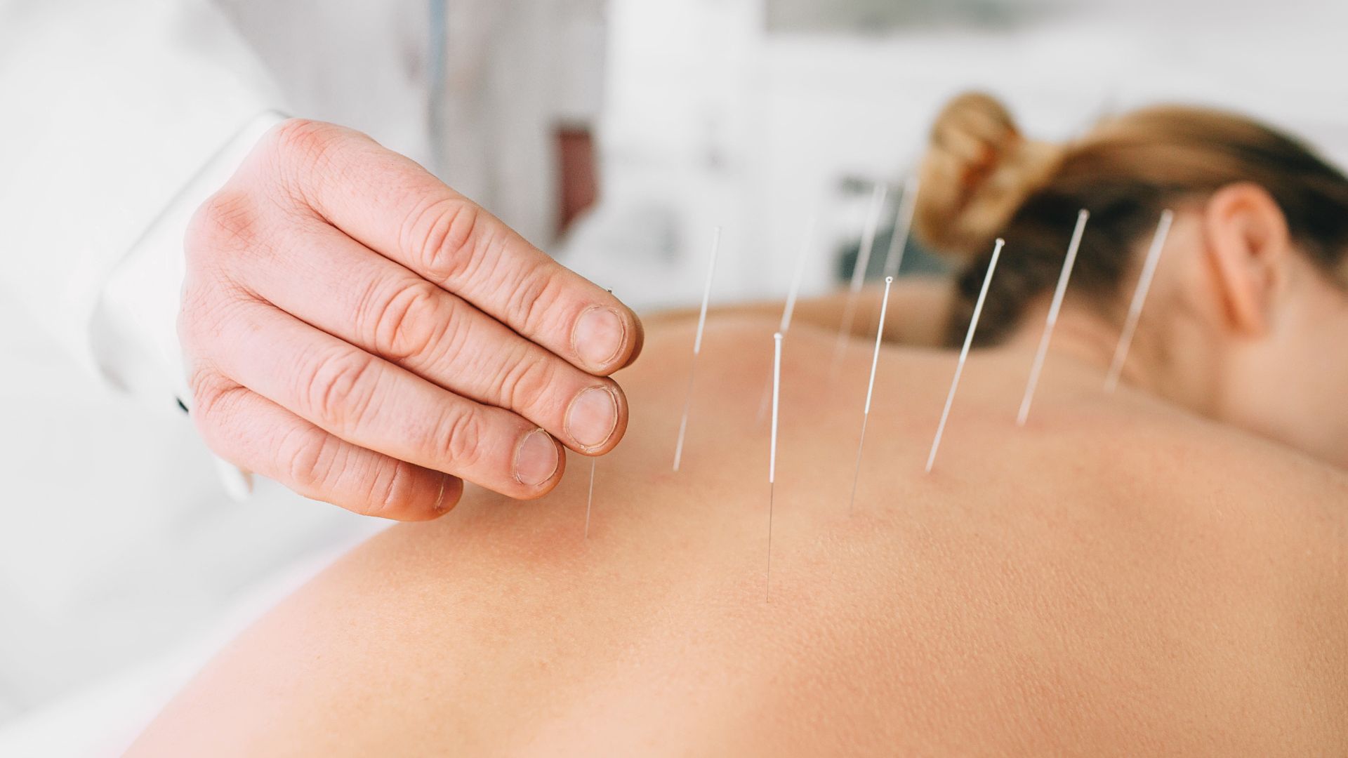 Nuovo Servizio di Agopuntura alla Domus Medica: un nuovo approccio per il benessere di corpo e mente
